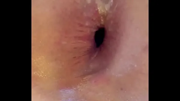 Mostrar Ass hole farts gapetubo de alimentación